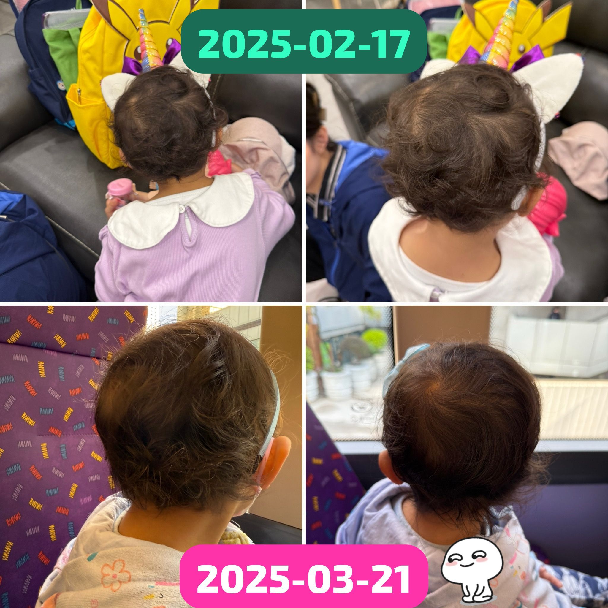 BUDS Hair Volume Booster 毛毛急急長 有機增髮精華 [100ml]